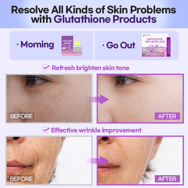 liposome glutathione direct ultra x review Amazon.com: ESTHER FORMULA Liposomal Glutathione Strips (30 ct) - Glutathione Direct, Antioxidant Support, Skin Glow Support | Sublingual Fast-Absorbing Oral Strips liposome glutathione direct ultra x review Amazon.com: ESTHER FORMULA Liposomal Glutathione Strips (30 ct) - Glutathione Direct, Antioxidant Support, Skin Glow Support | Sublingual Fast-Absorbing Oral Strips